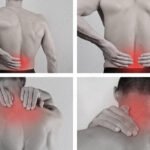 Alternatives to Epidural Steroid Injections: Back Pain Solutions