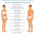 Alternatives to Abdominoplasty: Non-Surgical Solutions Explored