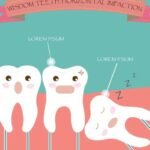 Alternatives to Wisdom Teeth Removal: Explore Options